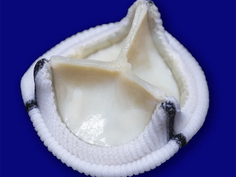 Bioprótese Cardíaca Aórtica Cardioprótese