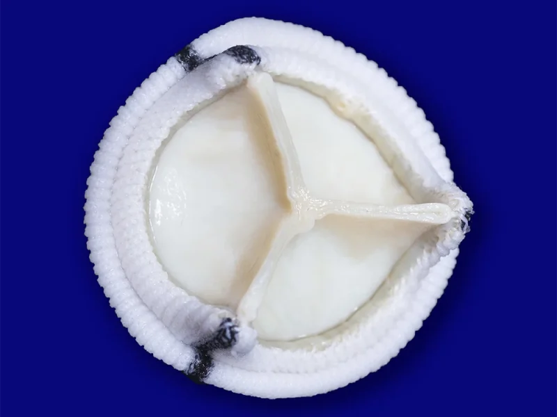 Bioprótese Cardíaca Mitral Cardioprótese