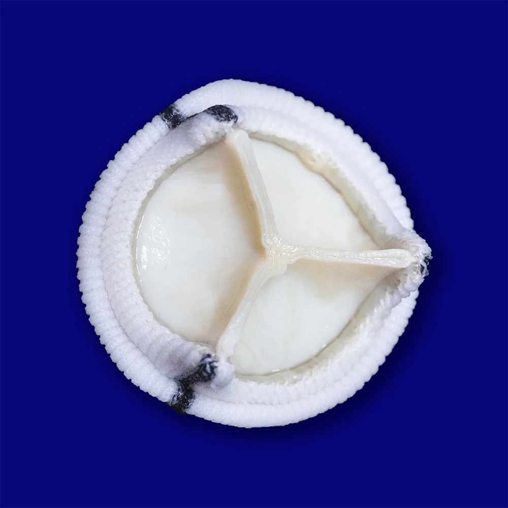 Bioprótese Cardíaca Mitral Cardioprótese