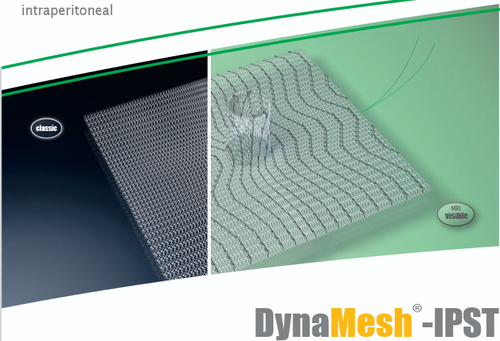 Produto DynaMesh® IPST