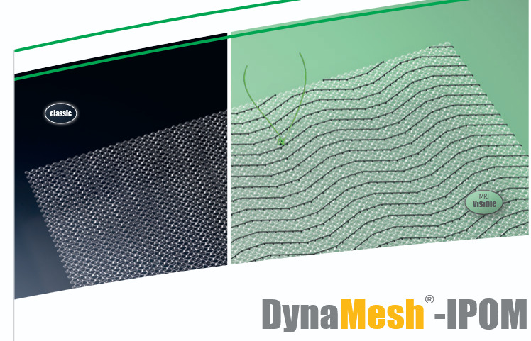 Produto DynaMesh® ipom